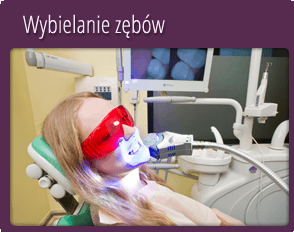 Wybielanie zębów